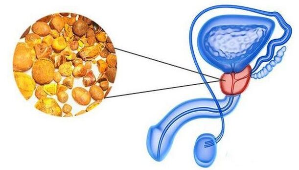 Berechnen Sie in der Prostata -Drüse