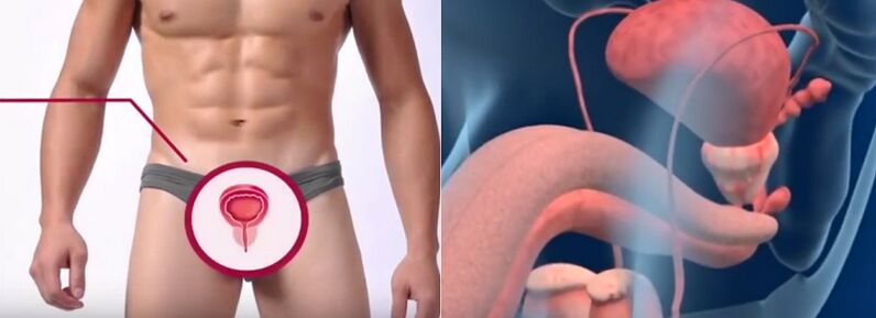 Prostatitis bei Männern, erkennbar an einigen Anzeichen